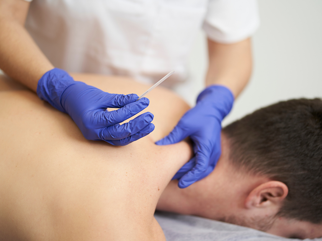Dry Needling: como o agulhamento a seco alivia dores musculares